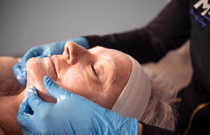 Close-up of a woman receiving an Age-Defying Chemical Peel service. 