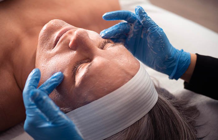 Close-up of a woman receiving a Tone-Balancing Chemical Peel service. 