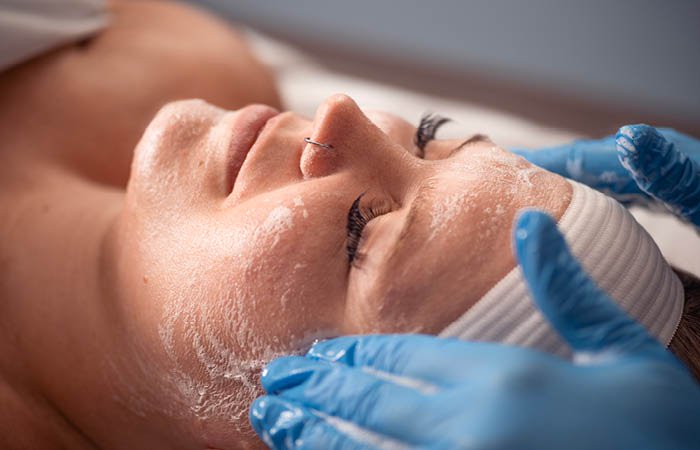 Close-up of a woman receiving a Clarifying Acne Chemical Peel service. 