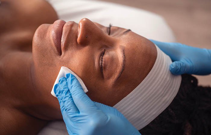 Close-up of a woman receiving a Brightening Chemical Peel service. 