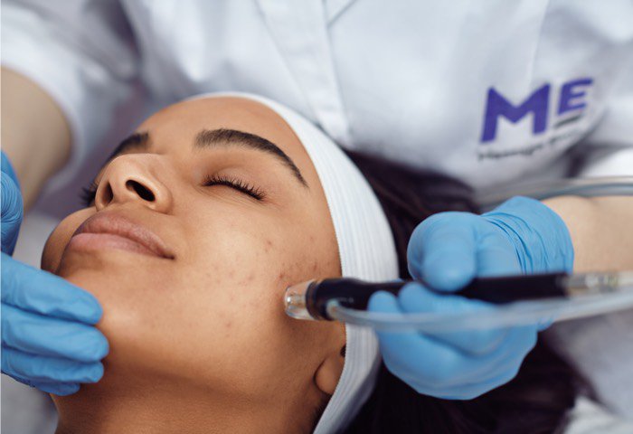 Microderm Infusion